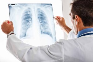 What Is An Occupational Disease Under South Carolina Law?